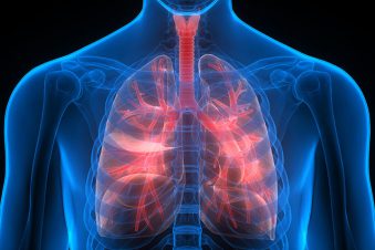 COPD-1 Molenhoek Fysiotherapie Vaassen